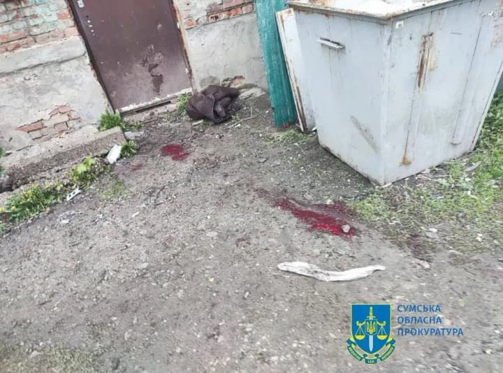 tiazhkoporanenyi-ale-zhyvyi-u-prokuraturi-pereprosyly-za-dezinformatsiiu-pro-zahybel-tsyvilnoho-u-bilopilli