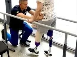 ministry-of-defense-there-are-fewer-people-with-amputations-as-a-result-of-the-war-than-people-realize