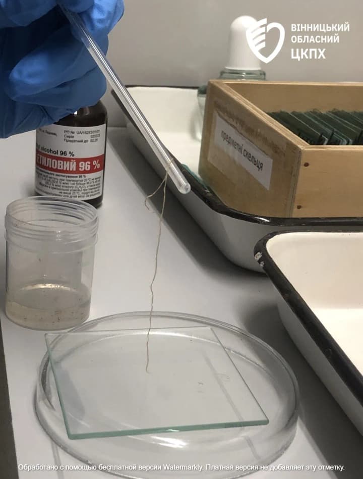 a-case-of-dirofilariasis-was-recorded-in-vinnytsia-region-what-is-important-to-know