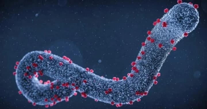 u-tsentri-hromadskoho-zdorovia-poiasnyly-chy-ye-v-ukraini-ryzyky-epidemii-virusu-marburh