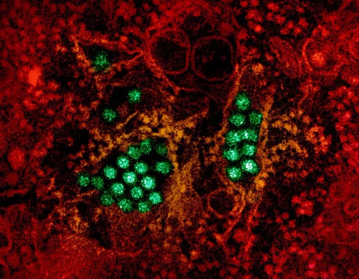 global-warming-accelerates-the-spread-of-dangerous-pathogens