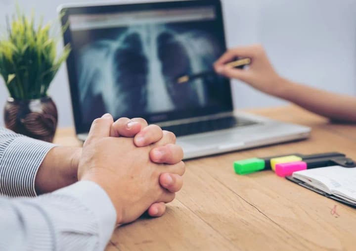 scientists-have-developed-a-unique-test-that-will-help-detect-lung-cancer-at-an-early-stage