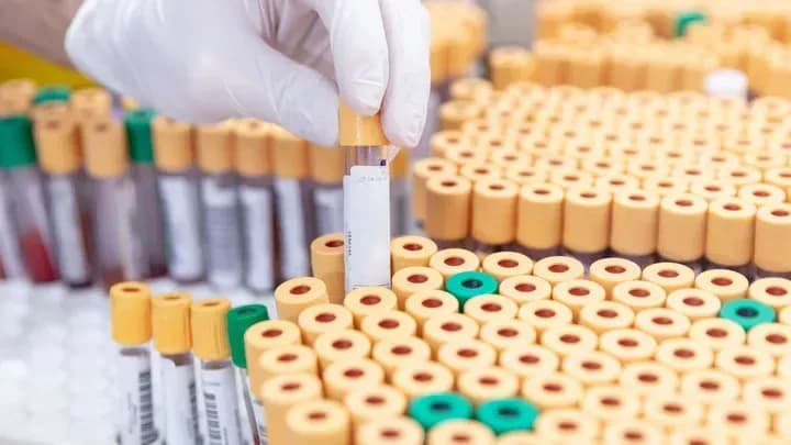 hundreds-of-samples-of-deadly-viruses-disappeared-from-australian-laboratory