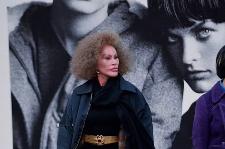 vidoma-cherez-chyslenni-plastychni-operatsii-zhinka-kishka-dzhoselin-vildenshtein-pomerla-u-vitsi-84-rokiv