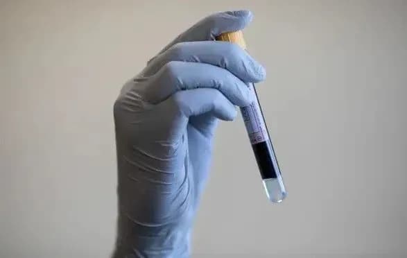 pervii-v-mire-analiz-krovi-na-endometrioz-stal-blizhe-posle-uspeshnogo-ispitaniya