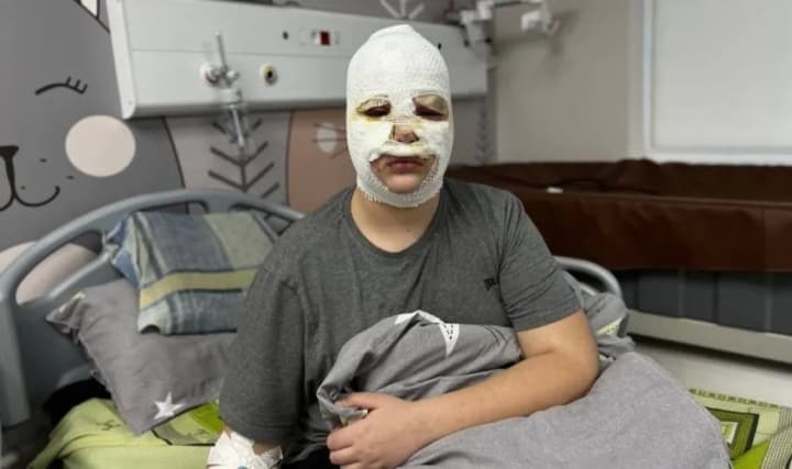 dangerous-tiktok-trend-three-children-were-injured-in-lviv-because-of-homemade-firecrackers