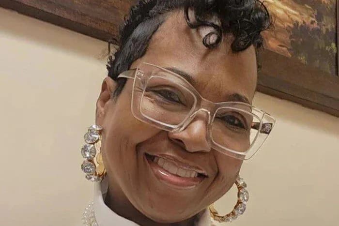 in-the-usa-a-woman-has-been-living-with-a-transplanted-pig-kidney-for-more-than-2-months