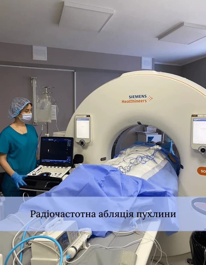 u-tsentri-shalimova-rozpovily-pro-efektyvnist-likuvannia-pukhlyn-pechinky-za-dopomohoiu-radiochastotnoi-abliatsii