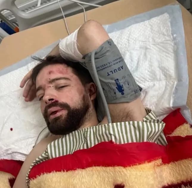 a-lecturer-at-lviv-university-was-found-beaten-and-unconscious-near-kyiv-what-is-known-what-are-the-questions-to-the-tcc