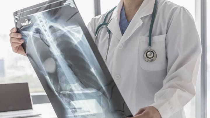 tuberkuloz-zalyshaietsia-dovoli-serioznym-vyklykom-dlia-systemy-hromadskoho-zdorovia-ukrainy-tshz