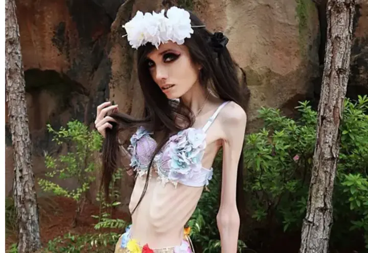 france-is-concerned-about-the-promotion-of-anorexia-in-tiktok-under-skinnytok