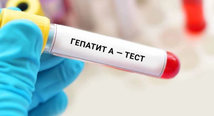 u-kyievi-zafiksovano-spalakh-hepatytu-a-medyky-zaklykaiut-do-posylenoi-hihiieny-ta-vaktsynatsii