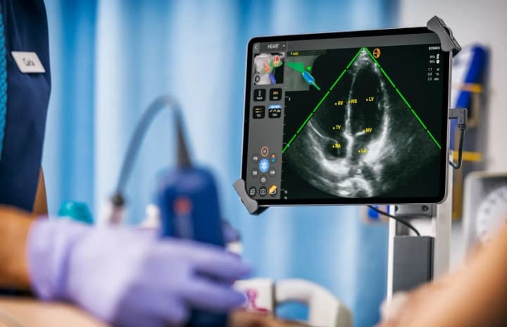 samsung-planiruet-investirovat-100-millionov-v-startap-exo-imaging-kotorii-revolyutsioniziruet-meditsinu