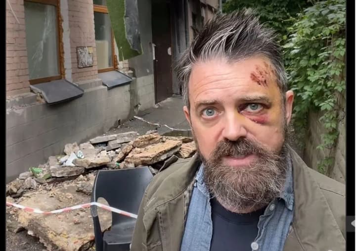 v-podolskom-raione-na-amerikantsa-upal-balkon-pered-vkhodom-v-podezd-mnogokvartirnogo-doma-kgva