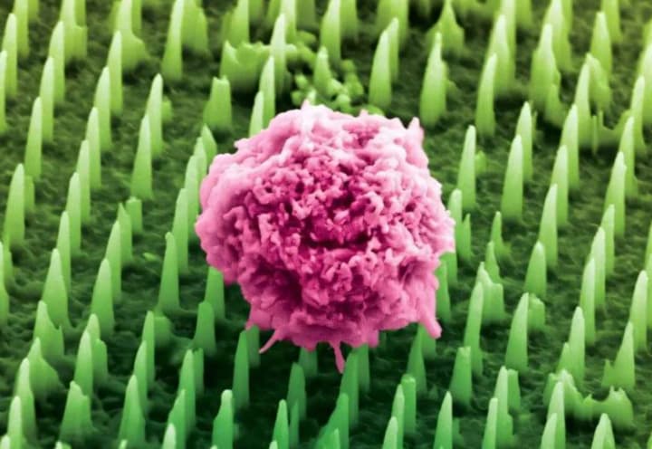 u-brytanii-stvoryly-bezbolisnu-alternatyvu-biopsii-nanoplastyr-dlia-diahnostyky-raku