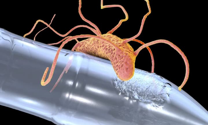 vcheni-znaishly-sposib-borotysia-z-bakteriiamy-za-dopomohoiu-plastyku