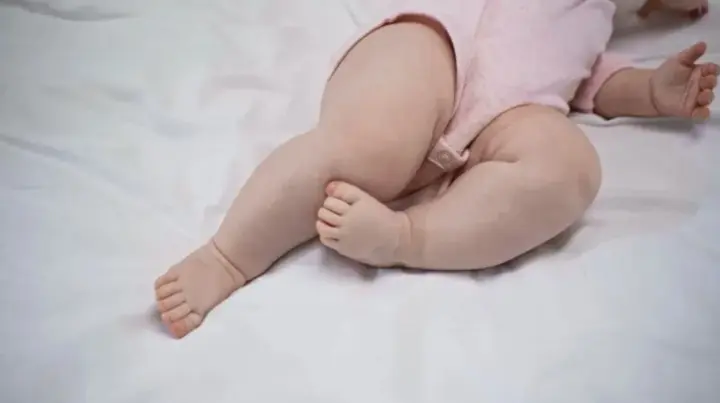 v-shvetsii-u-10-misiachnoi-divchynky-ziavyvsia-mikropenis-prychyny-anomalii-ziasuvaly-likari