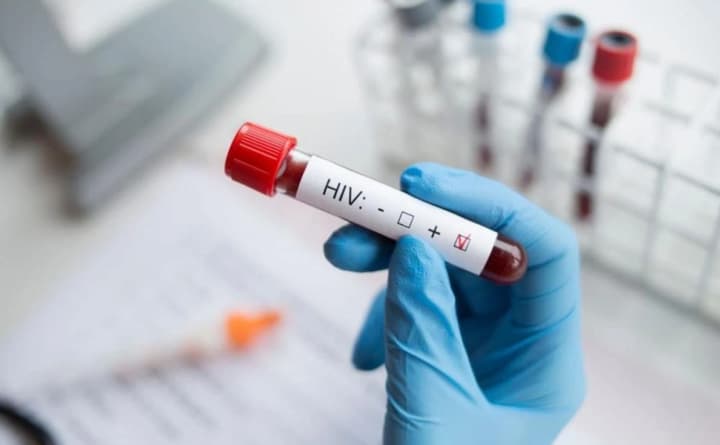 russia-maintains-the-highest-proportion-of-hiv-positive-population-in-europe-intelligence