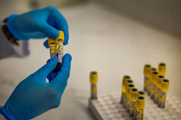 ukraine-recorded-over-600-new-hiv-cases-and-200-aids-cases-in-a-month