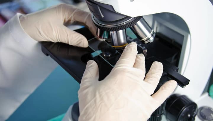 u-kalifornii-pidtverdyly-mozhlyve-povernennia-serednovichnoi-chumy-u-meshkantsia-pozytyvnyi-test-pislia-ukusu-blokhy