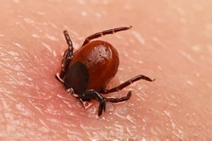first-death-from-meat-allergy-after-tick-bite-recorded-in-us