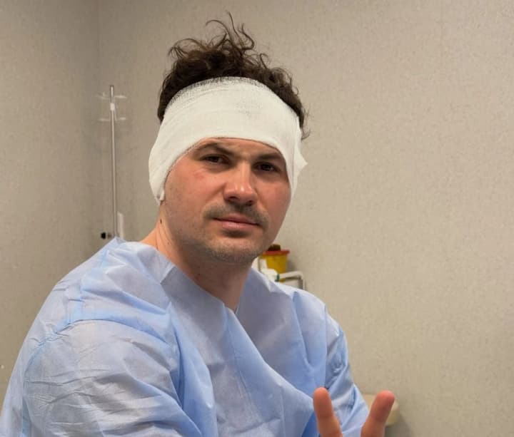zhenia-kot-perenis-operatsiiu-i-pokazavsia-z-pereviazanoiu-holovoiu-tantsiuryst-rozpoviv-pro-svii-stan