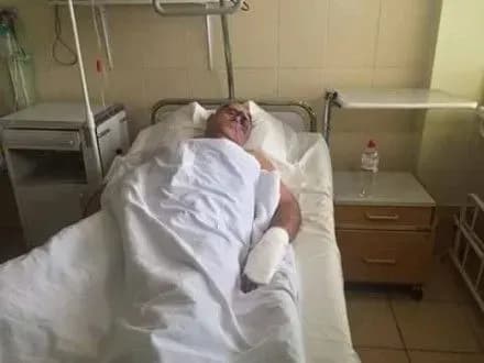 На Одещині побили голову районної ради