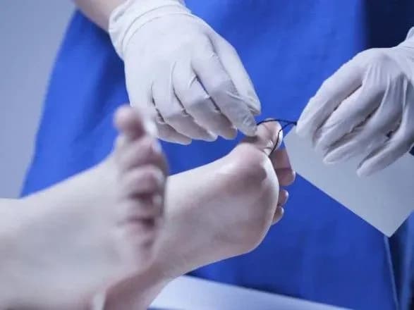 У Нацполіції заявили про проблеми з термінами поховання людей