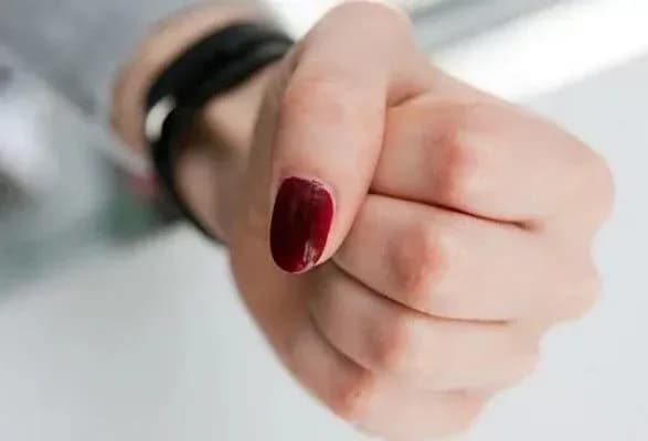 Побиття школярки в Одесі: постраждалій надають психологічну допомогу