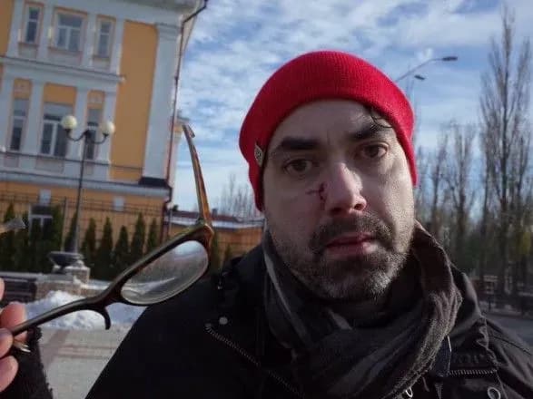 Під час акції в підтримку трансгендерів постраждав канадський журналіст