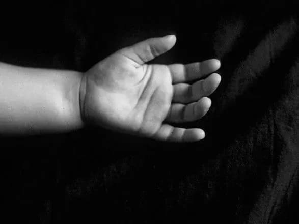 У Львові від кору помер дворічний хлопчик