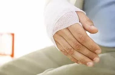 У гуртожитку 18-річний хлопець отримав опіки другого ступеня