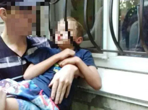 Маленький хлопчик застряг головою у віконній решітці