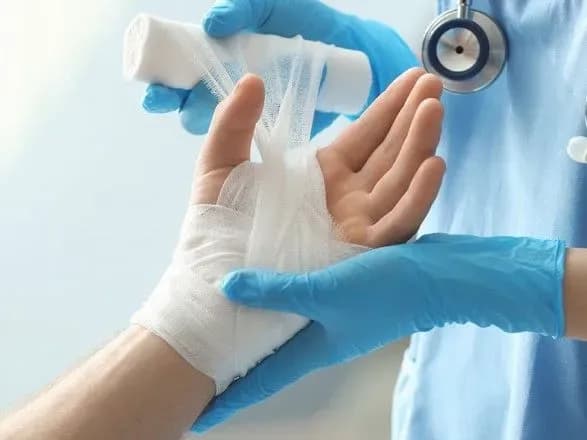 Став відомий стан постраждалого на пожежі військового на Львівщині