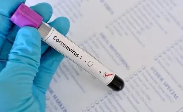 Смертельний коронавірус: які спеціалісти входять до оперативного штабу реагування в Україні