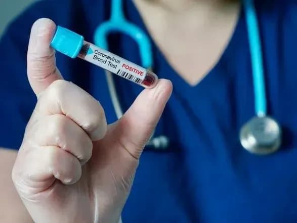 Обещанные МОЗ тест-системы для выявления коронавируса - на финальном этапе проверки