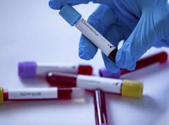 В Минздраве рассказали об особенностях захоронения людей умерших от коронавируса