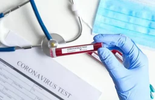 Ще троє мешканців Дніпропетровської області захворіли на коронавірус