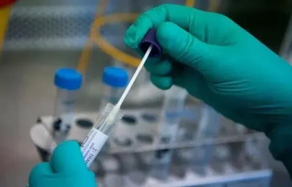 На Рівненщині підтверджено 10 нових випадків COVID-19