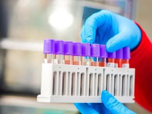 Пневмонія у хворих COVID-19 може початися і без температури - Голубовська