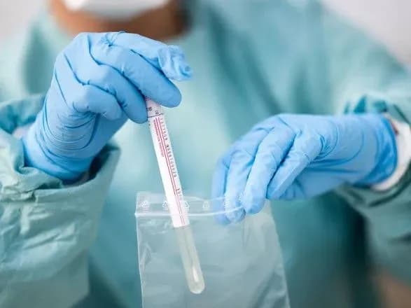 На Львівщині уже 825 випадків інфікування коронавірусом