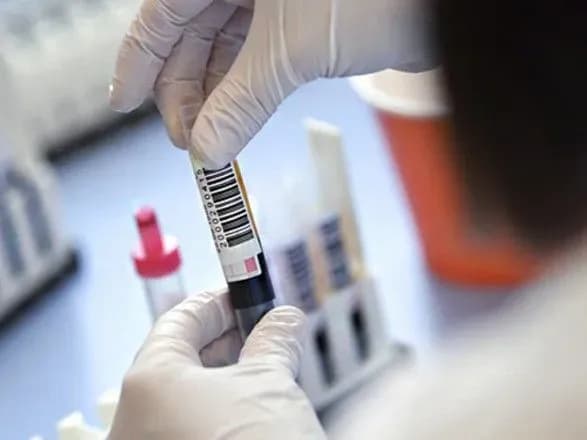 Владельцы и руководители общественных заведений должны организовать ИФА-тестирование сотрудников - Кличко