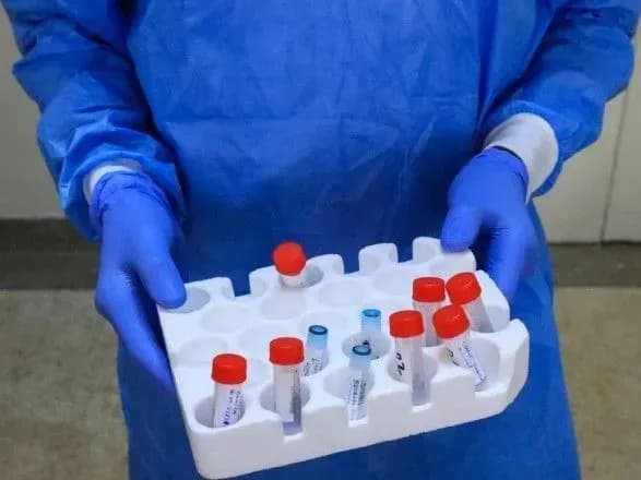 В Україні вже 51,2 тис. випадків COVID-19, за добу - 810