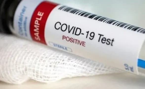 У Києві за добу COVID-19 виявили у 277 людей