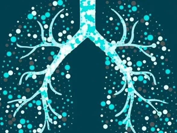 За серпень в Україні зареєстровано близько 1200 випадків туберкульозу