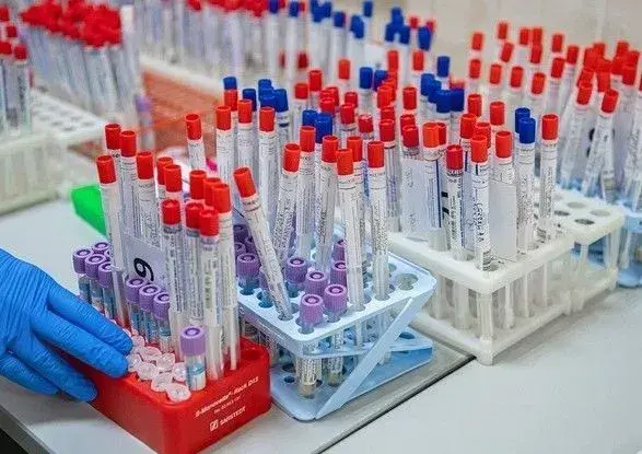 В Україні вже 250 тис. випадків COVID-19, за добу знову антирекорд - 5 804