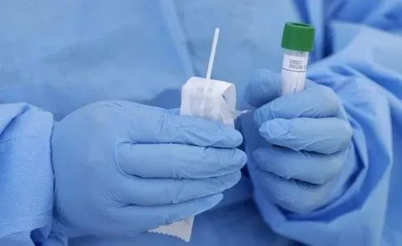 Степанов пообіцяв вирішити проблему з чергами на ПЛР-тестування в Україні