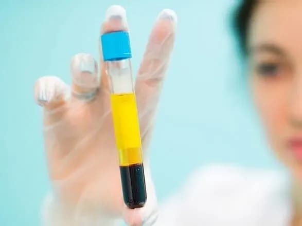 Хворих на COVID-19 відтепер лікуватимуть "антиковідною" плазмою з крові перехворілих - нові протоколи МОЗ