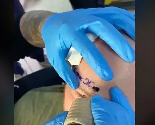 Харьковчанин набил себе на лбу татуировку "Кернес Жив"