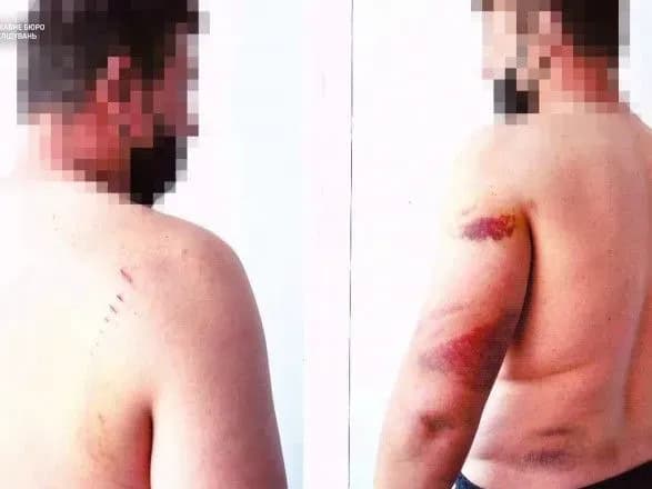 На Херсонщині експоліцейському загрожує до 8 років за побиття підозрюваних